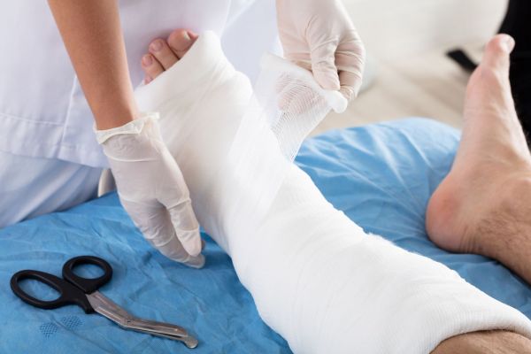 Nurse applying cast to leg